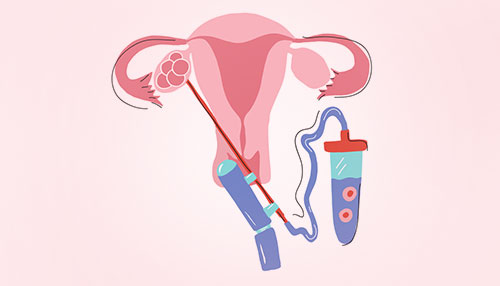 Gynaecology and Urogynaecology treatment in anand