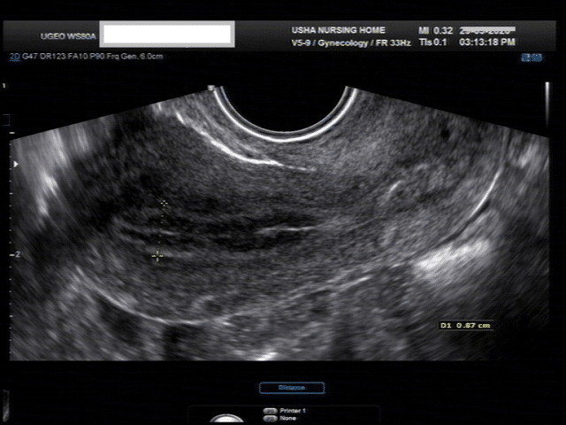 3D Ultrasound Procedure in Anand