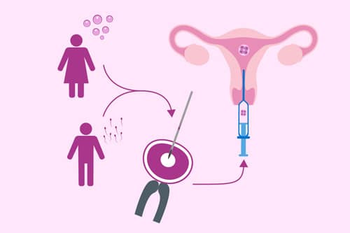 Surrogacy IVF treatment in Gujarat