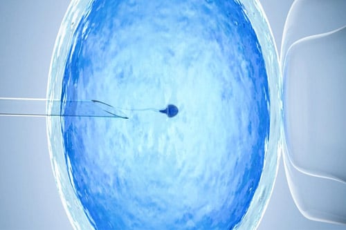 Intracytoplasmic sperm injection Procedure in Usha Nursing Home