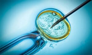 Preimplantation Genetic DiagnosisPGD Treatment in Anand