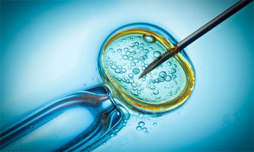 Preimplantation Genetic Diagnosis(PGD) Treatment in Anand