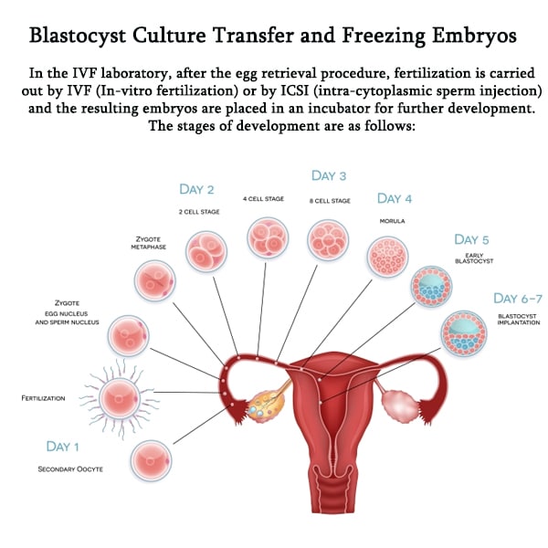Blastocyst Culture Transfer and Freezing Embryos