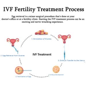 IVF Fertility Treatment Process Best IVF Centre in Anand