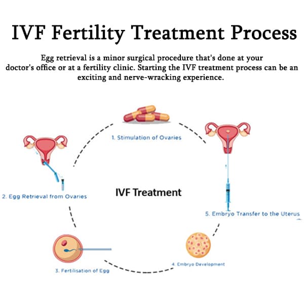 IVF Fertility Treatment Process