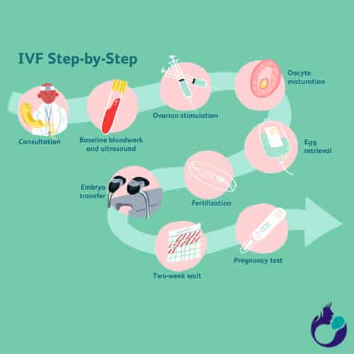 IVF Procedure Steps by Usha Nursing Home
