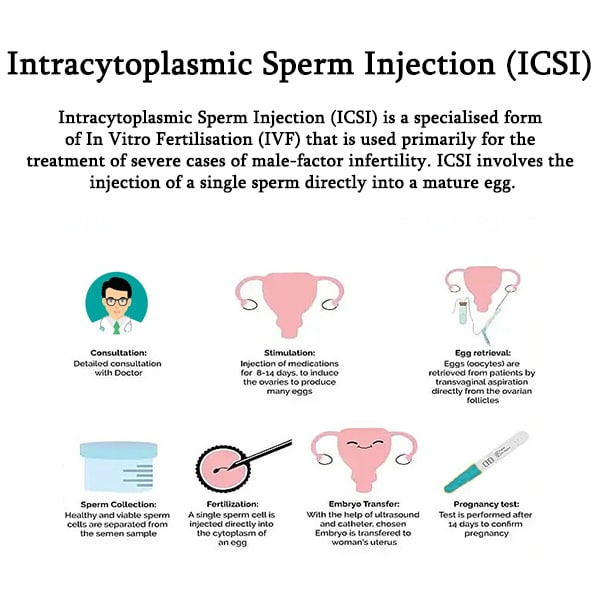 Intracytoplasmic Sperm Injection ICSInbsp