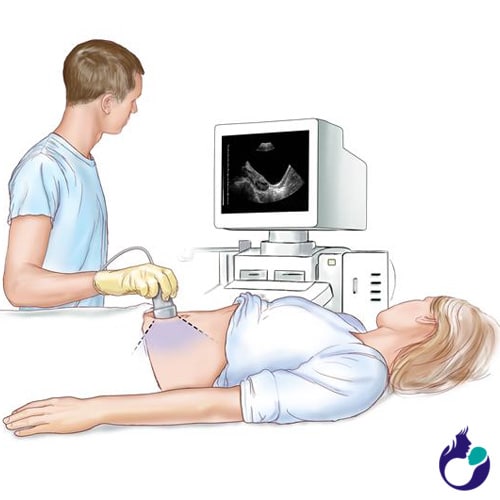 3d ultrasound pictures in Anand Gujarat 