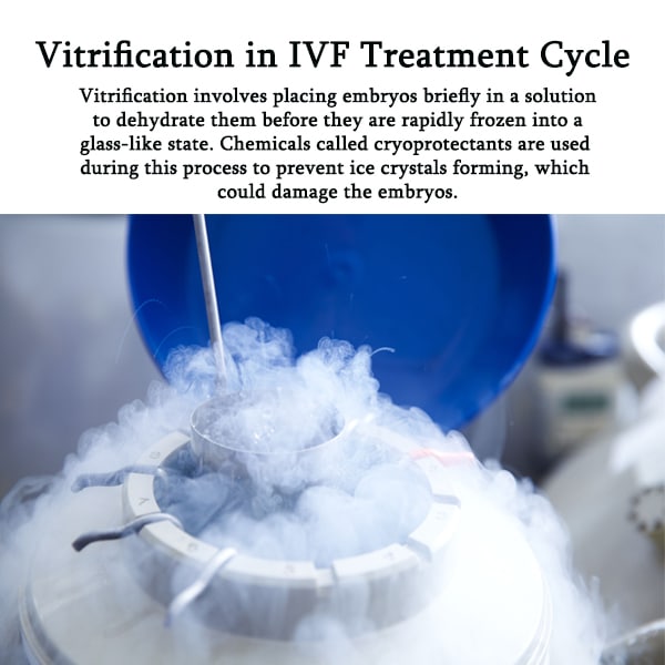 Vitrification in IVF Treatment Cycle