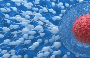 Treatment of zero sperm count Azoospermianbsp