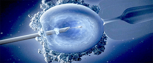 Laser Hatching in IVF in Anand