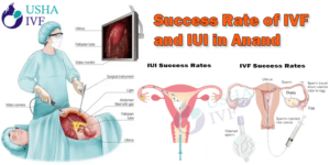 Success Rate of IVF and IUI in Anandnbsp