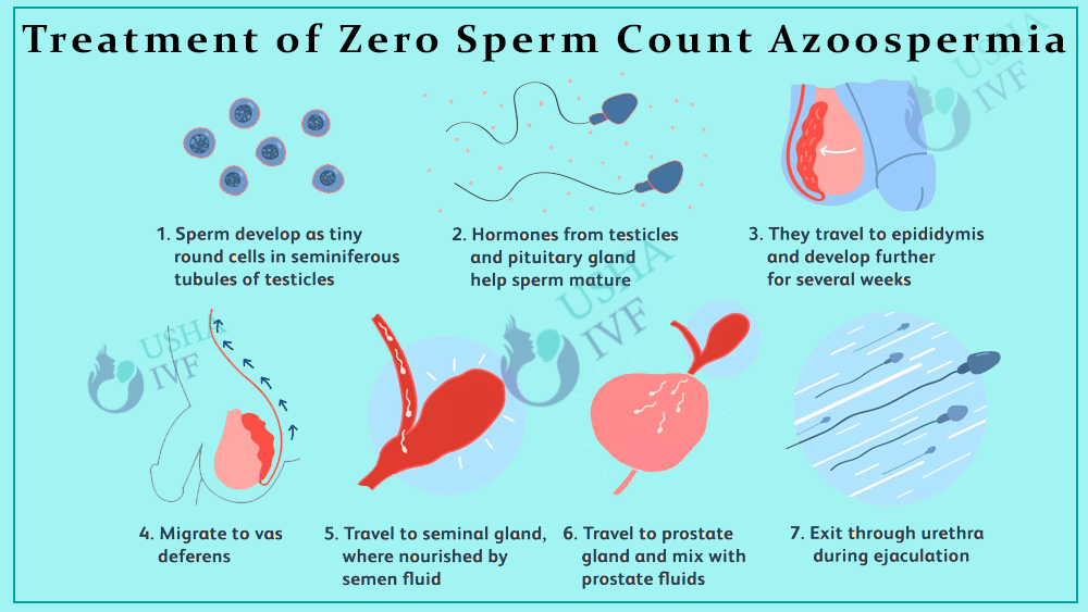 Treatment of zero sperm count Azoospermia in Anand, Gujarat