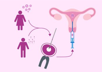 Surrogacy IVF treatment in Gujarat