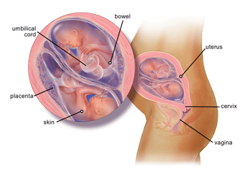 Twin Pregnancy Treatment