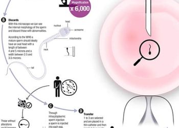 IMSI in IVF Treatment in Anand, Gujarat