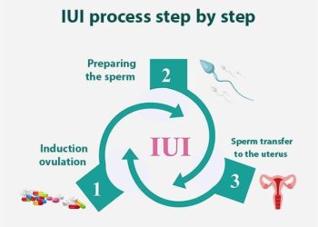 IUI treatment in Anand